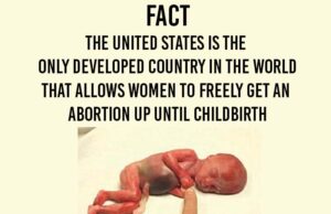 The US is the only developed country in the world that allows unrestricted Abortion on Demand – FACT